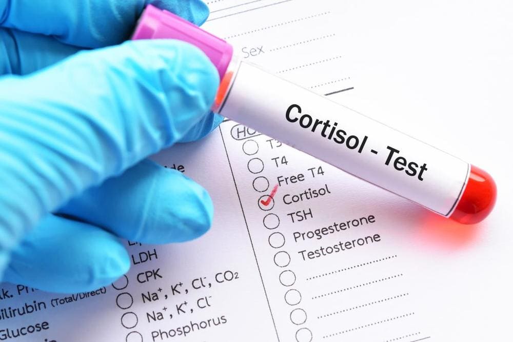 9-19 cortisol-test