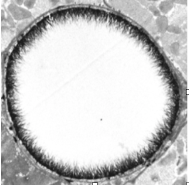 THE ENDOTHELIAL GLYCOCALYX