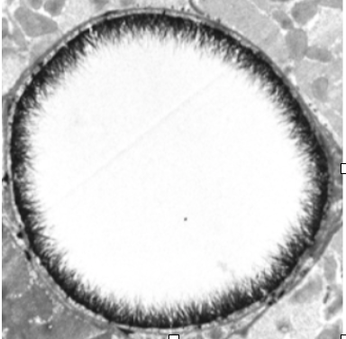 THE ENDOTHELIAL GLYCOCALYX- PART I