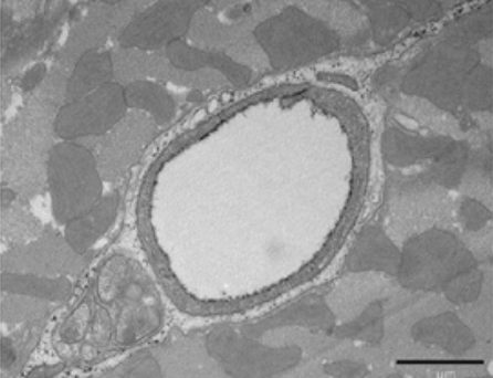 THE ENDOTHELIAL GLYCOCALYX-PART II